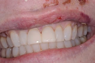 Before After Dental Case