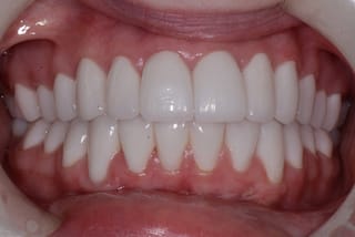 Before After Dental Case