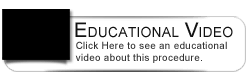 Dental Education Video - Stages Of Gum Disease